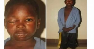 Boy Eye Removed by Suspected Ritualists